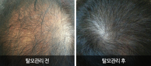 참사랑의원피부과